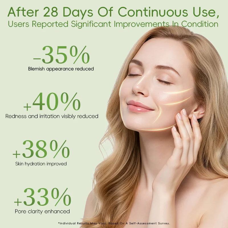 Infographic displaying skincare results after 28 days of continuous use, featuring a smiling woman with statistics on blemishes, redness, hydration, and pore clarity improvement.